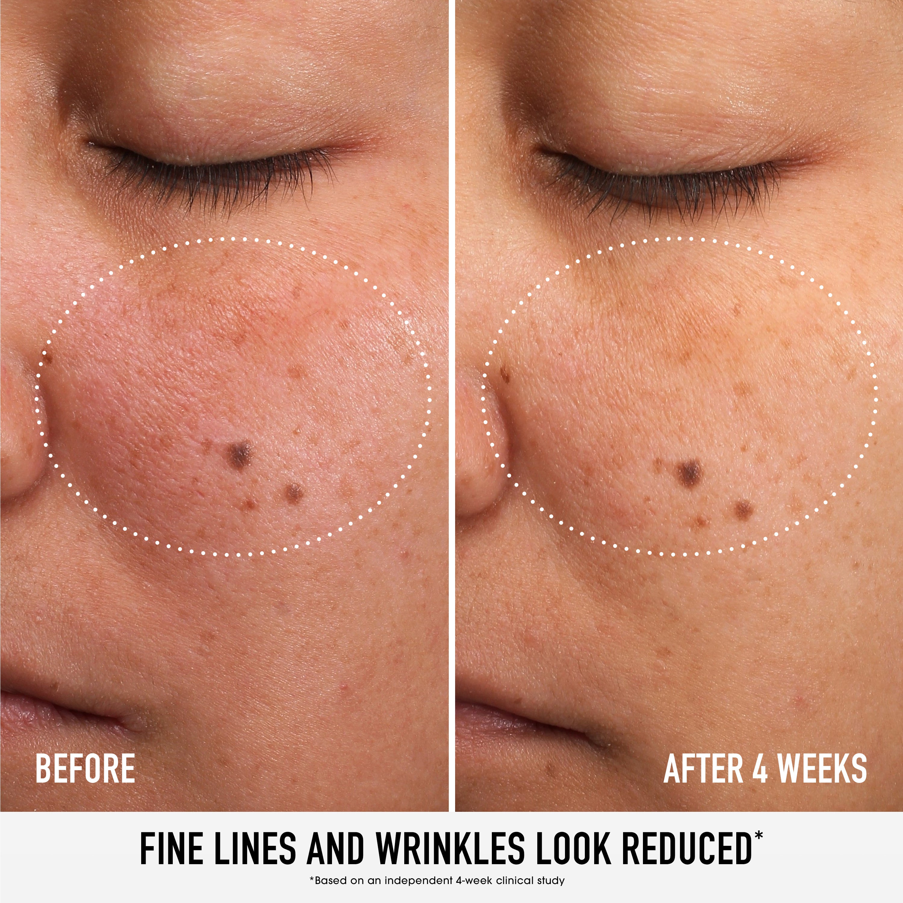 SKIN RESCUE Pure Smooth Serum with 5% Niacinamide and Chebula view 2