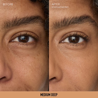 Medium Deep